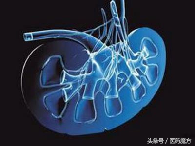 晚期肾细胞癌术后使用舒尼替尼辅助治疗可延长无病生存期1.2年