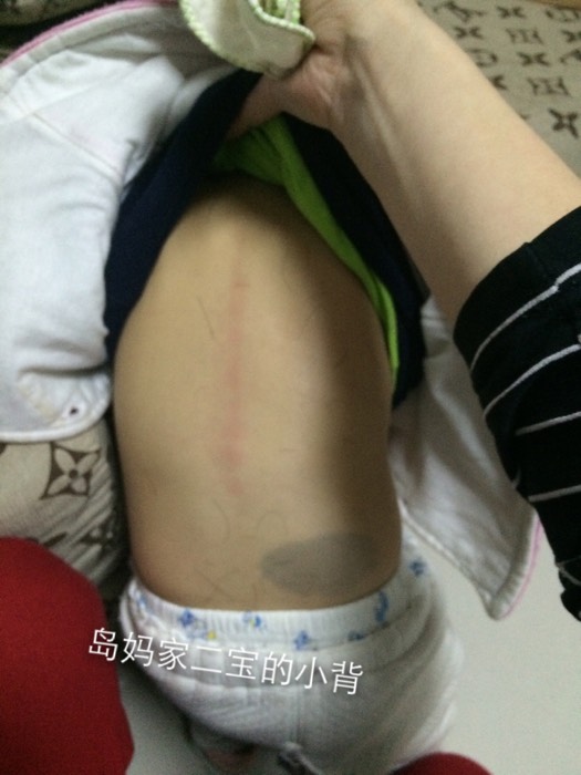 宝宝去火最有效的方法,不吃药的降火方法