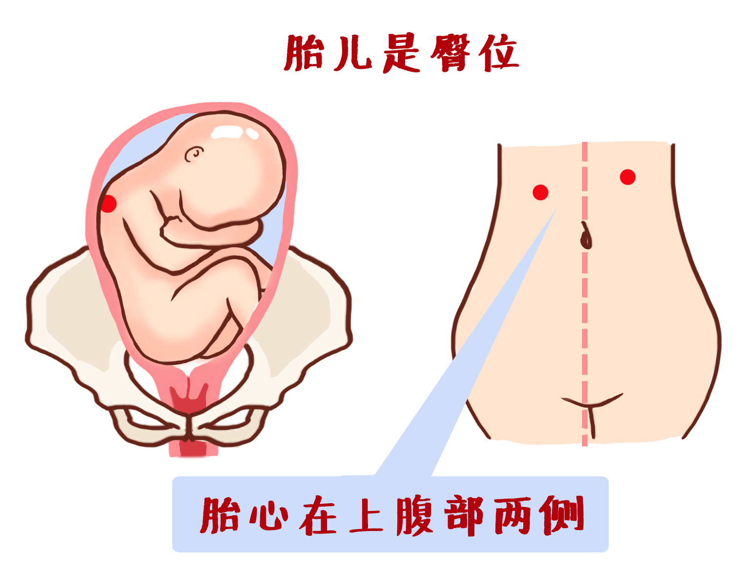 产检全过程详细讲解 (最全产检时间表新手妈妈必收藏)