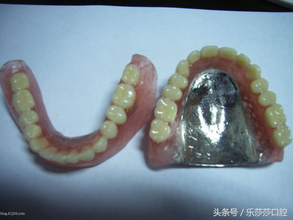 装一口假牙是怎样的一种体验？