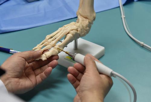 20岁脚趾外翻矫正,踇外翻的处理过程视频