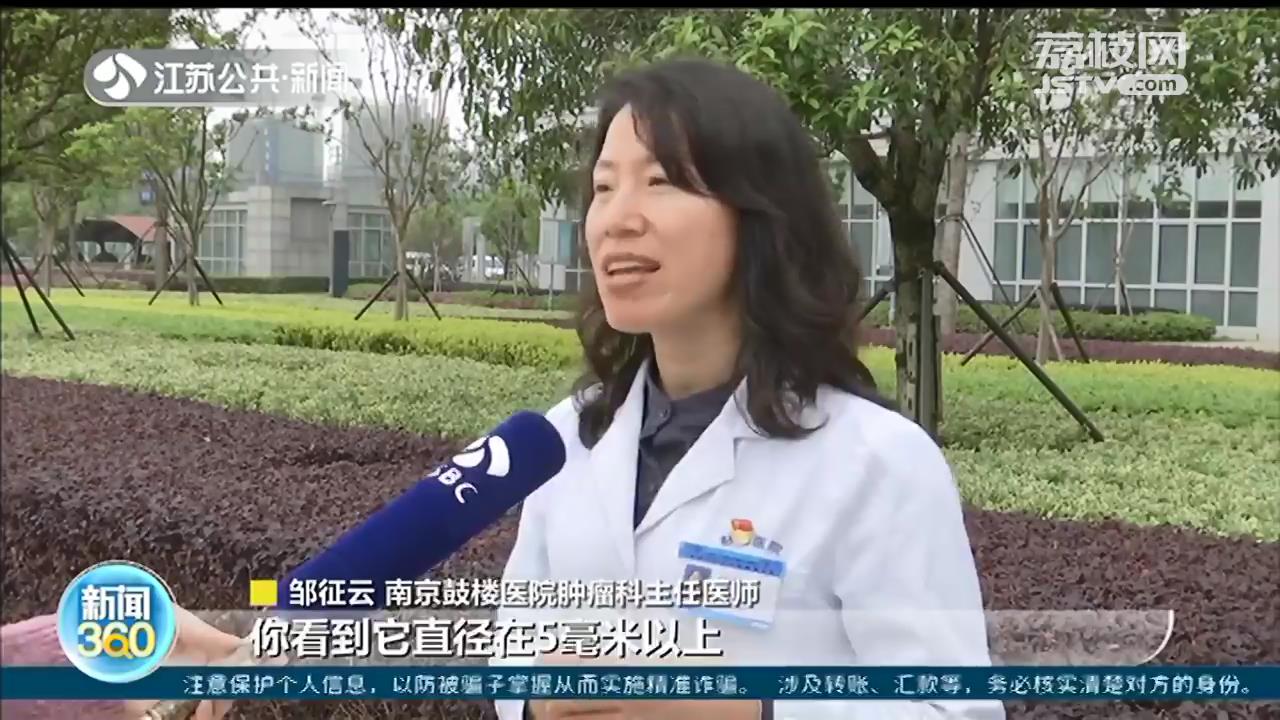 头皮黑色素瘤原因,头皮黑痣长大了怎么办