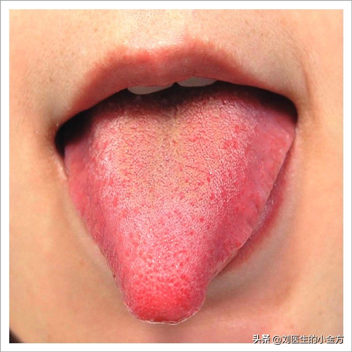 舌象图解大全中医舌诊,最全中医舌诊图谱来了