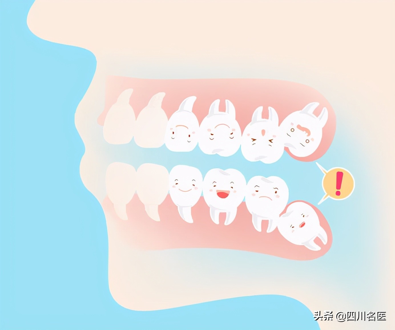 智齿一次拔几颗比较好,智齿到底要不要拔掉一个视频