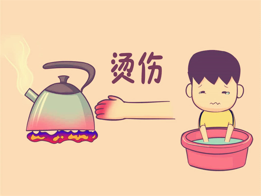 妈妈不小心被女孩烫伤,孩子被烫伤记住四件事情