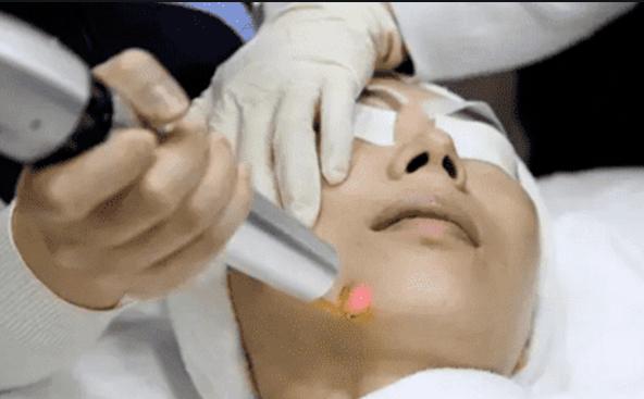 经常说的医美是什么,你真的了解医美吗