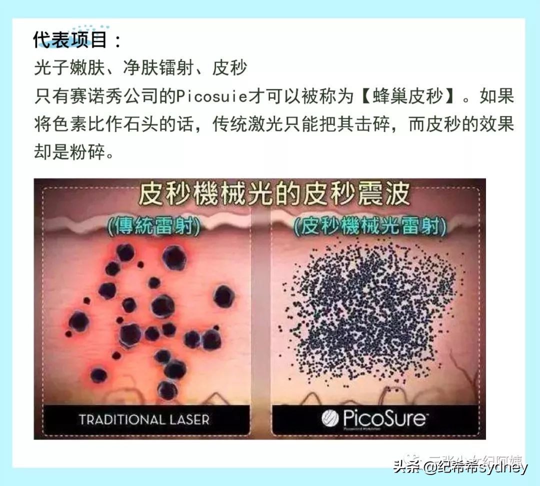 热玛吉超声刀光子嫩肤,超声炮热玛吉光子嫩肤的区别