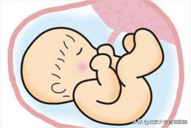 胎盘增厚是nt增厚吗,胎盘突然增厚会导致胎盘早剥吗