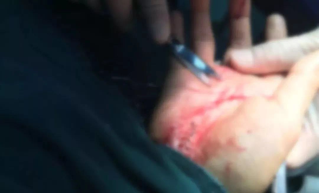 缉毒警察抓吸毒人员吗,缉毒警察疑感染艾滋病