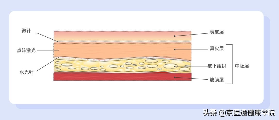 菲洛嘉打多了会怎么样,菲洛嘉一般多少钱可以打