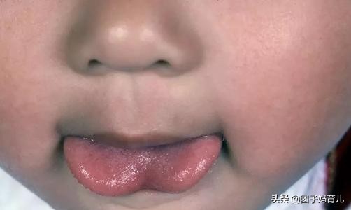 孩子不会说话姥姥说没剪舌根,孩子不讲话剪舌根