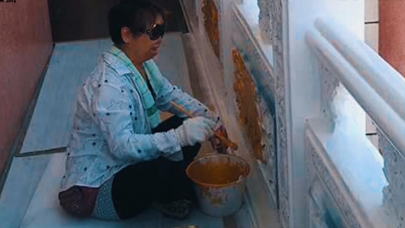 20岁小伙被重度烧伤七年后续,20岁严重烧伤毁容