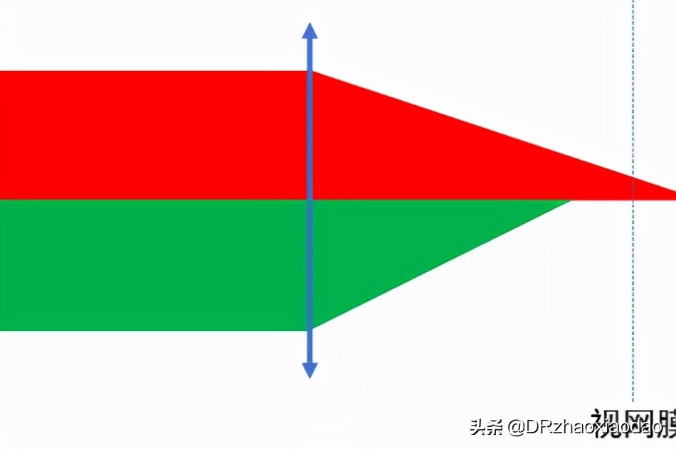 视力1.0+正常吗,视力1.0+能降低眼睛度数吗