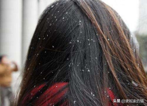 头屑多头痒用什么洗发水比较好,头屑多比较油用什么洗发水最好