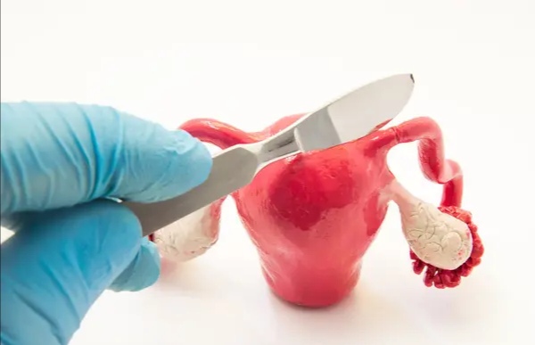 子宫不全切,子宫可以不切吗