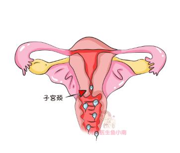 受孕期如何避开不怀孕,怎样备孕防止停孕