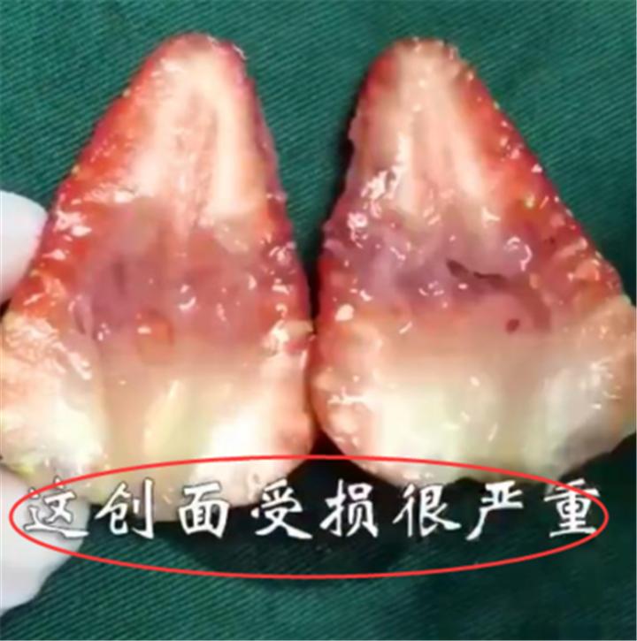 人流对女人伤害多大,人流对女性造成的伤害多久才会好