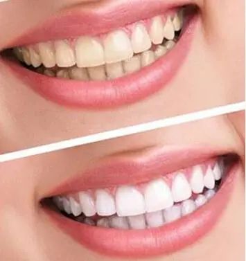 儿童护牙食谱大全,儿童保护牙齿食谱图片大全