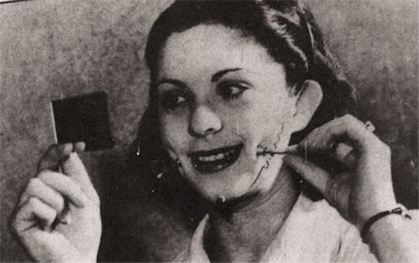 整形人工酒窝,人工做酒窝好看吗