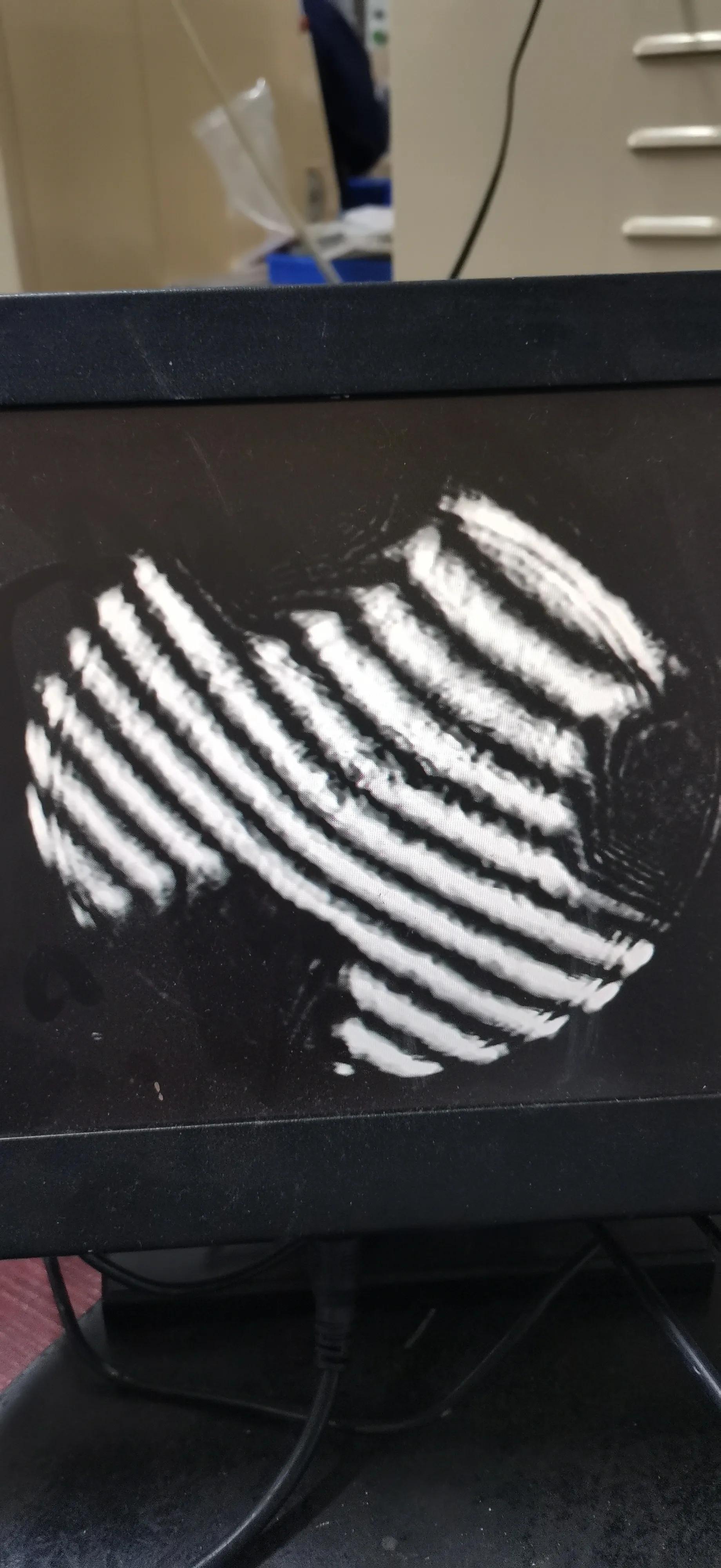 研磨痕产生的原因,研磨抛光出现划痕怎么处理