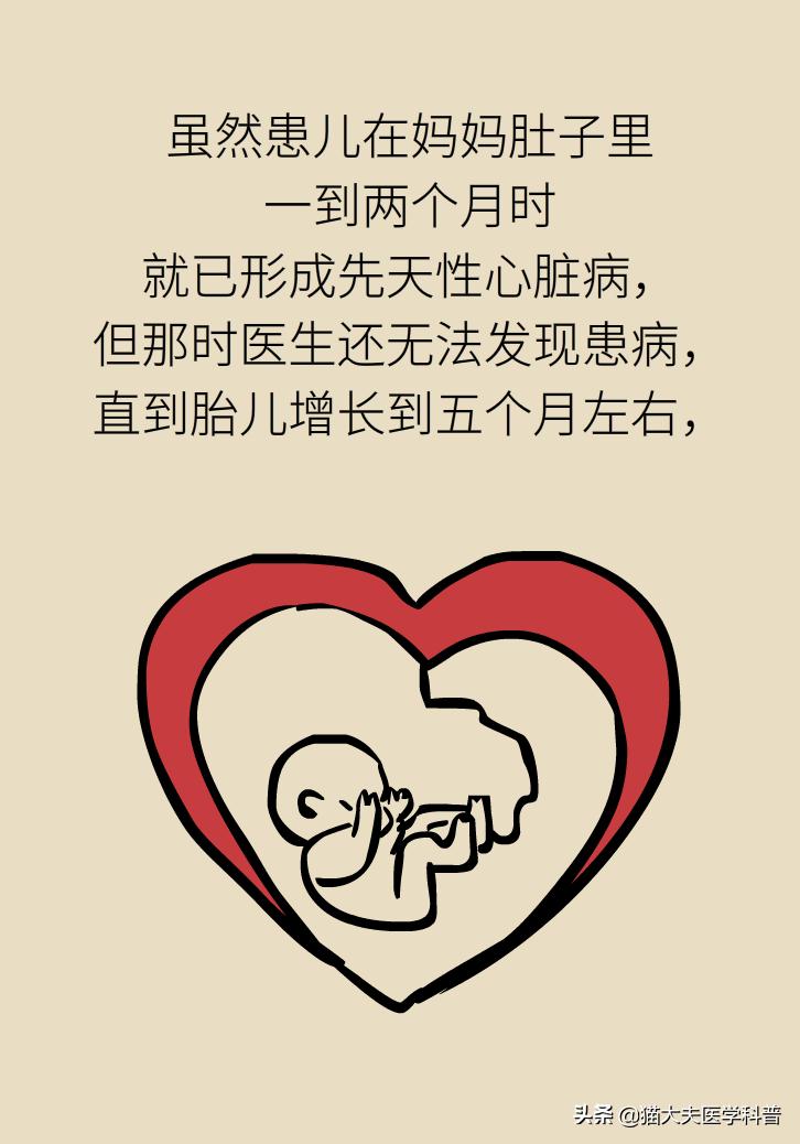 产检查出胎儿有问题,胎儿心脏有问题产检能发现吗