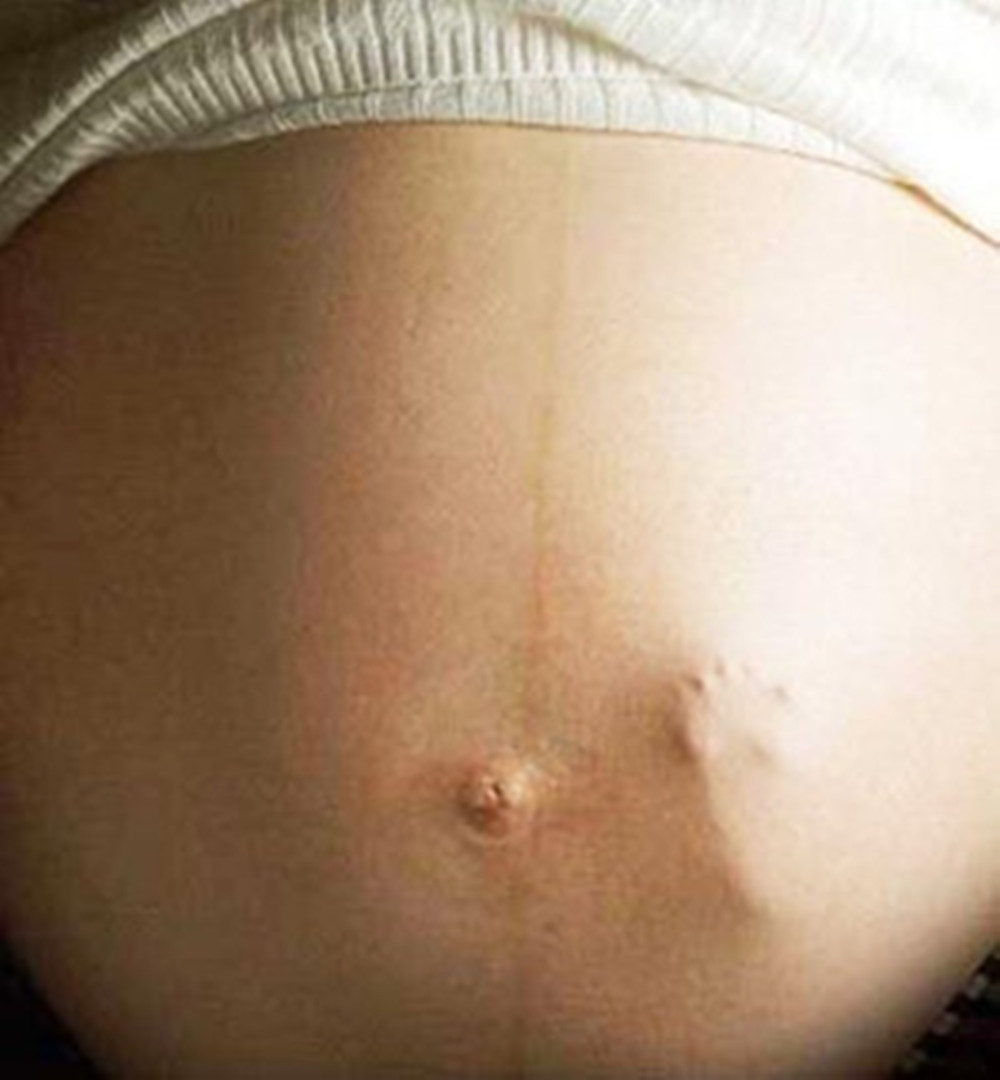 左边规律的胎动说明宝宝在干嘛,胎动在左侧代表胎宝宝在做什么