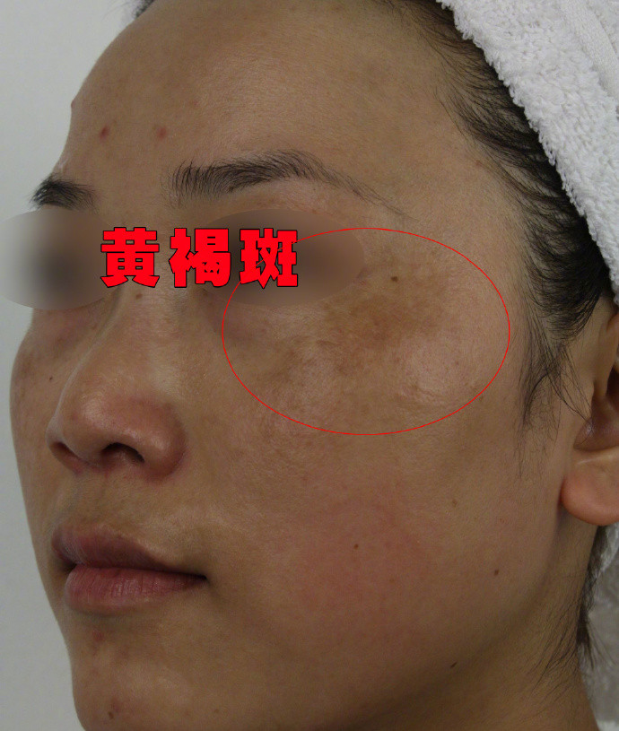 怎么改善肤色黄暗沉,怎么才能改善暗黄淡斑