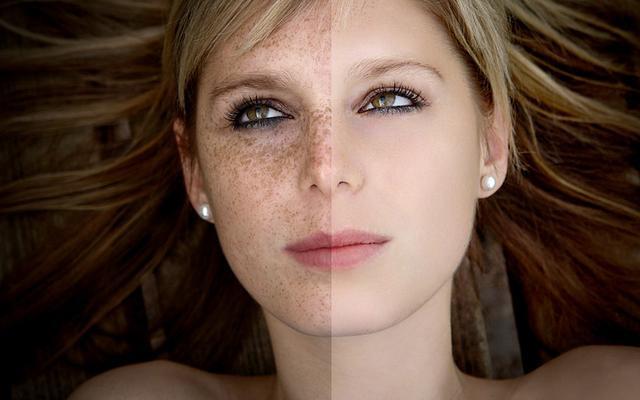 祛斑食疗方,祛斑的三个食疗小妙招