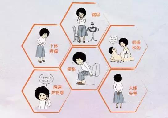 盆底康复，女人一生的必修课