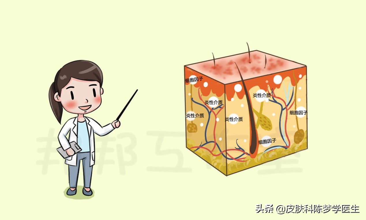 不同分期的湿疹怎么治疗,湿疹痒痒的有什么办法治好吗