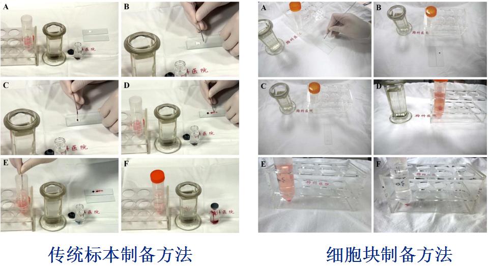 孙加源门诊,治疗肺癌的新技术新手段