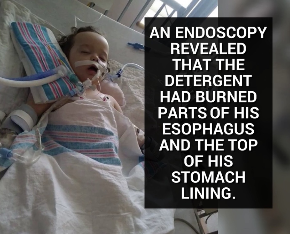 孩子误吞异物爸爸成功获救新闻,一岁男童玩耍吞洗衣凝珠