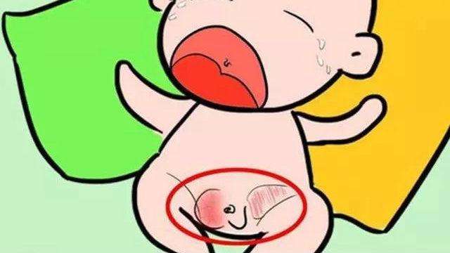 婴儿腹部突出有疝气,宝宝肚脐疝气鼓包图片