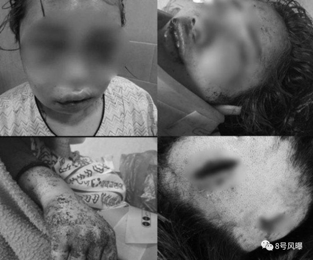 韩国14岁少女被打,韩国22岁女孩惨遭暴打