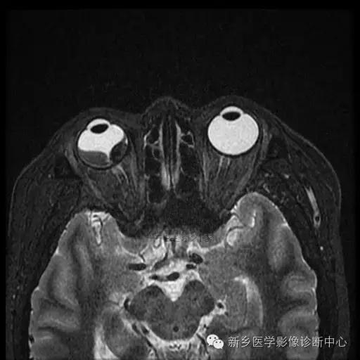 这些部位的黑色素瘤，您会诊断吗？