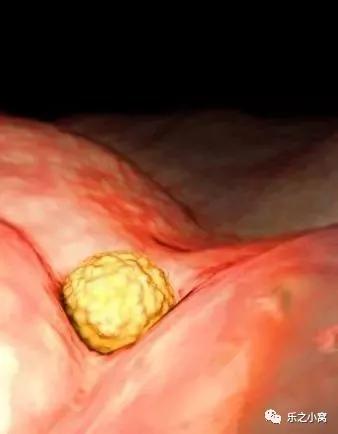 孕期胎儿成长图鉴,孕期胚胎成长图片