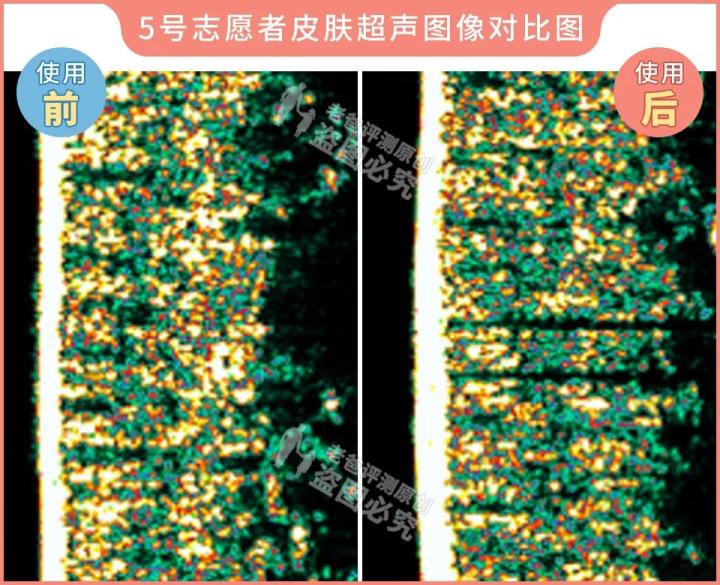300块的网红美容仪有效果吗,网红家用美容仪测评