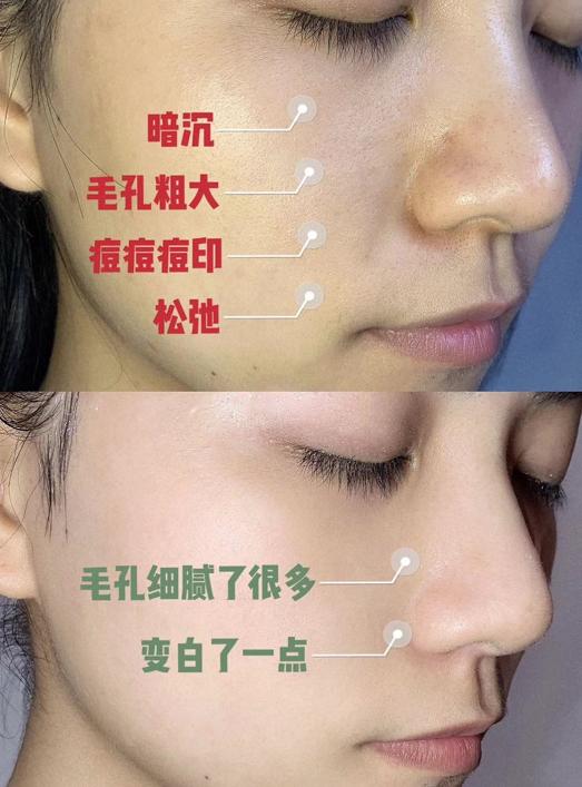 陈乔恩为什么越来越漂亮,陈乔恩肌肤娇嫩