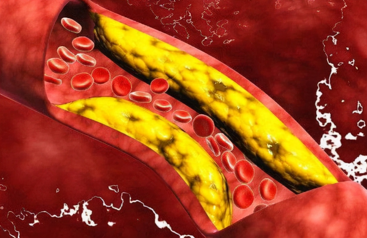a型ab型b型o型哪种血型的人体质好,a型b型o型ab型哪种血型身体好