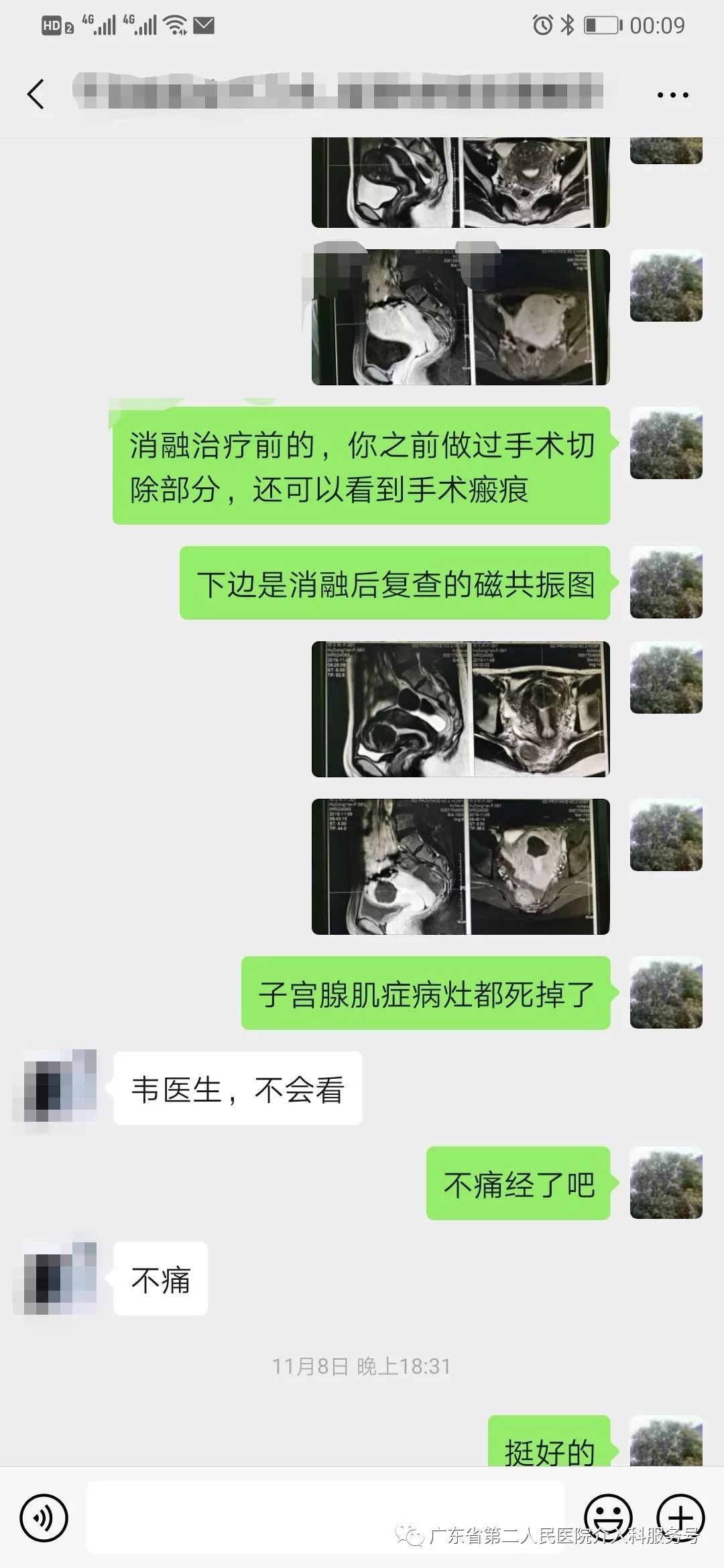 子宫腺肌症痛经伴有大小便也痛,子宫腺肌症痛经切除子宫能根治吗