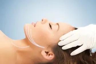 华西整形修复,华西整形科修复