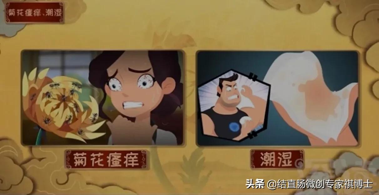 什么是混合痔疮的症状,女性痔疮和脱肛的症状