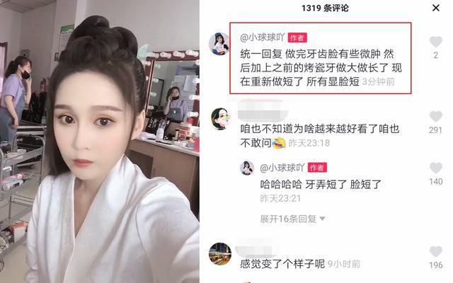 赵本山女儿整容被质疑,赵本山女儿花30万整容遭亲妈痛批