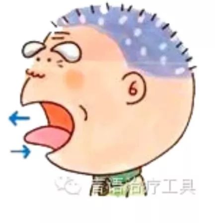 吞咽功能障碍康复训练手法,吞咽功能障碍传统康复治疗方法