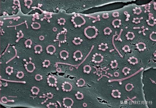 泌尿生殖系统支原体感染症状严重吗,泌尿生殖系支原体感染概述