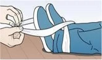 运动损伤的治疗与康复知识点,运动损伤的诊治