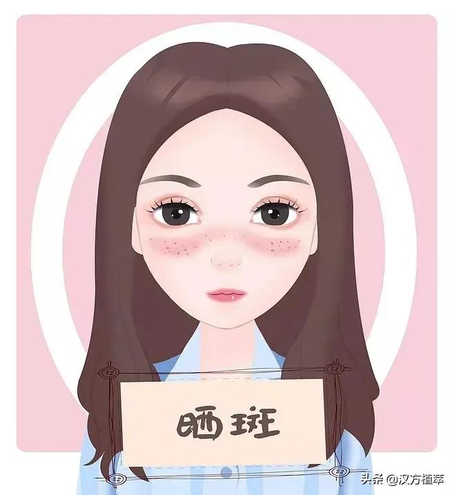 做斑一年了皮肤有点红,做斑后会变得很老吗