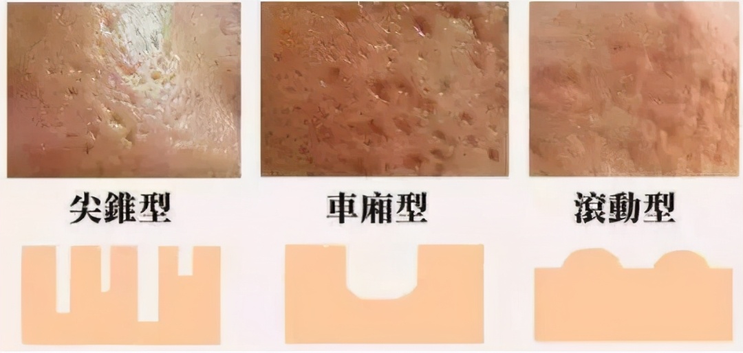 值得做的医美项目有哪些,哪些值得做的医美项目