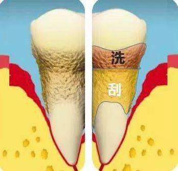 情人节不想开口牙黄很丢人？这招能让你牙白有气质！