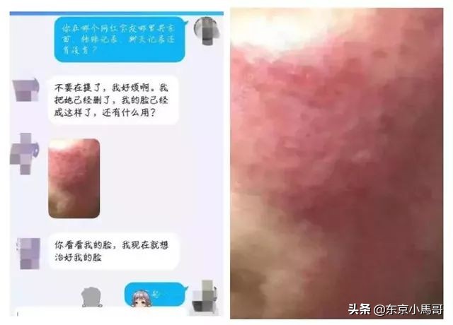 cpb隔离小样都是假的吗,cpb长管隔离有没有10g的小样